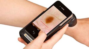 Ứng dụng điện thoại giúp phát hiện ung thư da qua nốt ruồi